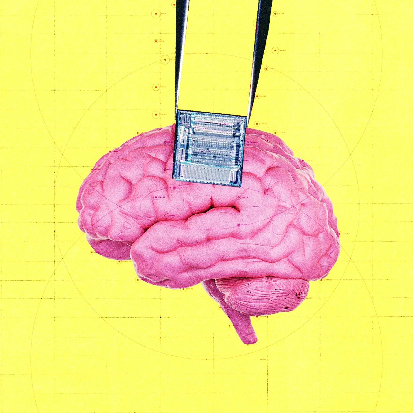OpenAI rót tiền vào startup dùng chip não phát hiện ung thư
