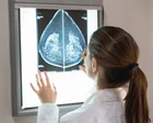 AI trên nhũ ảnh có thể phát hiện bệnh tim ở phụ nữ