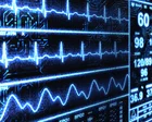 AI phát hiện bệnh tim dưới 2 giây